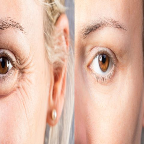 Glow & Rejuvenate MEDSPA