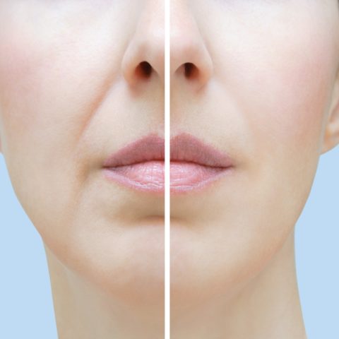 Glow & Rejuvenate MEDSPA